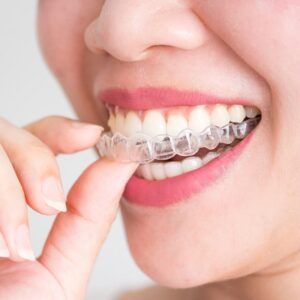 您必须穿Invisalign®多长时间？